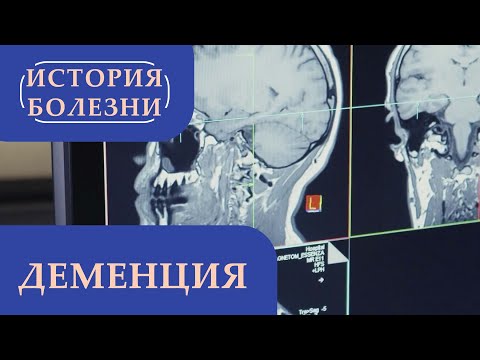 Деменция | «История болезни»