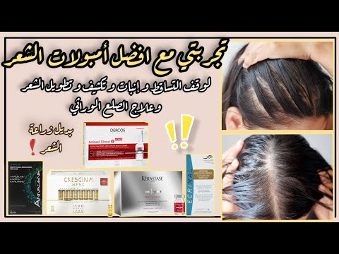 العلاج السحري لتساقط الشعر افضل امبولات الشعر انبات و تكثيف وتطويل الشعر بديل زراعة الشعر
