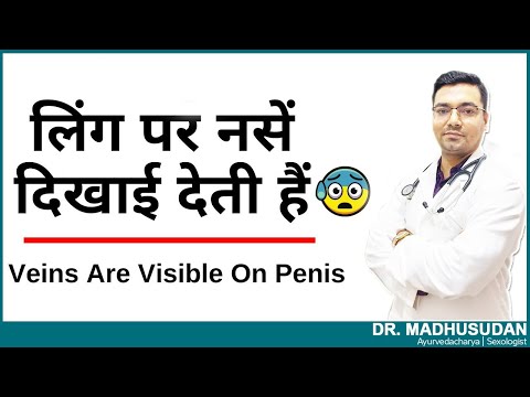 लिंग पर नसों का दिखना ! || Veins Are Visible On The Penis || Dr. Madhusudan