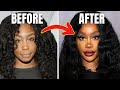 Unveiling SZA&#39;s Plastic Surgery Secrets: $250K Procedure!! (2023)