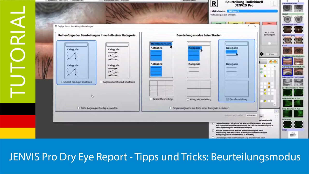Jenvis Report.pdf JENVIS Pro Dry Eye Report - Tipps und Tricks: Beurteilungsmodus - YouTube