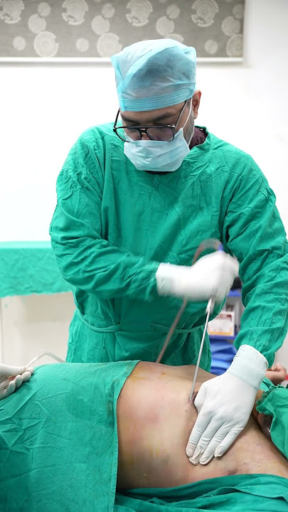 Gynecomastia Surgery | Gynecomastia Surgery Video | Gynecomastia Surgery cost