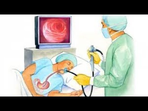 Video: Gastroskopija - Priprava, Indikacije, Kontraindikacije
