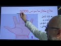 متلازمة سودس  أخطر اعراض كوفيد ٢٥متلازمة نقص الأكسجين المفاجئ    