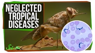 3 Deadly Diseases You've Probably Never Heard Of