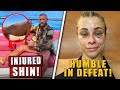 Conor McGregor SHOWS OFF injured shin two weeks after UFC 257, Paige VanZant reacts after loss, BKFC