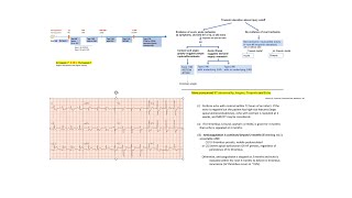 STEMI part 3 +Approach to all MIs and troponin grades + subtle STEMI cases (OMI) + LV thrombus