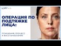 💆  Операция по подтяжке лица: показания, процесс и восстановление. Операция по подтяжке лица. 12+