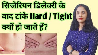 After cesarean delivery | Scar becoming tight after cesarean delivery | C-section delivery scar h... screenshot 5
