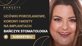 Licówki porcelanowe, korony i mosty na implantach Bańczyk Stomatologia.