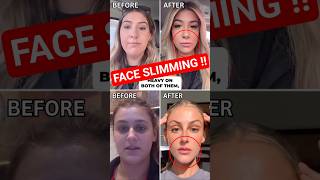 Why Are People Making Their Faces Hollow !!??
Like what you hear? Don’t forget to subscribe and leave a 5-star review!
Products Mentioned in This Video:
- - - - - - - - - - - - - - - - - - - - - - - - - - - - - -
SHOP: https://store.rajanimd.com/ USE Coupon Code SKIN10 for 10% Off. These are the EXACT Products Dr Rajani uses for himself and his patients.
- - - - - - - - - - - - - - - - - - - - - - - - - - - - - - -
FREE TIP: https://store.rajanimd.com/signup Want a tip each week? Click above to join my newsletter.
- - - - - - - - - - - - - - - - - - - - - - - - - - - - - - -
ASK ME: https://store.rajanimd.com/suggest Suggest a topic or ask a question for me to answer on the show!
- - - - - - - - - - - - - - - - - - - - - - - - - - - - - - -
LEARN: https://store.rajanimd.com/school Free courses and how to tutorials
- - - - - - - - - - - - - - - - - - - - - - - - - - - - - - -
FTC: Some links included in this description might be affiliate links. If you purchase a product through one of them, I will receive a commission (at no additional cost to you). I truly appreciate your support of my channel. Thank you for watching! Video is not sponsored. DISCLAIMER: This video does not contain any medical or health related diagnosis or treatment advice. Content provided on this YouTube Channel is for informational purposes only. For any medical or health related advice, please consult with a physician or other healthcare professionals. Further, information about specific products or treatments within this video are not to diagnose, treat, cure or prevent disease. Why Are People Making Their Faces Hollow !!??