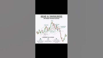 Head and shoulder pattern #headandshoulders #pattern