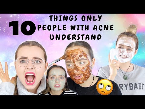  THINGS ONLY PEOPLE WITH ACNE UNDERSTAND! | Conagh Kathleen