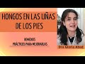 HONGOS EN LA UÑAS  TRATAMIENTO Y PREVENIR  📌  [ TIPS para MEJORAR uñas CASERO] 📌