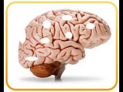 Brain Boosting Foods - The 1 Worst Food that Harms Your Brain