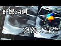 妊娠34週突然の宣告 （心室中隔欠損症 重複腎盂 鎖肛 胎盤癒着）