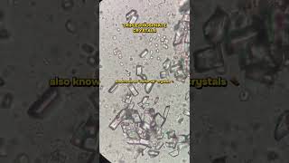 Triple Phosphate Crystal ✨ #trending #microscope #shortsfeed #science #viral #trending #like #share