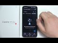 Xiaomi 17T/17T Pro: How to Fix Contacts Not Showing