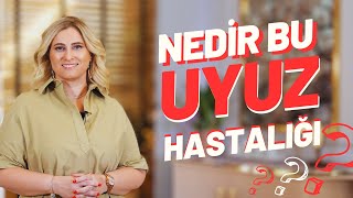 Nedir Bu Uyuz Hastalığı? I Prof. Dr. Arzu Ataseven