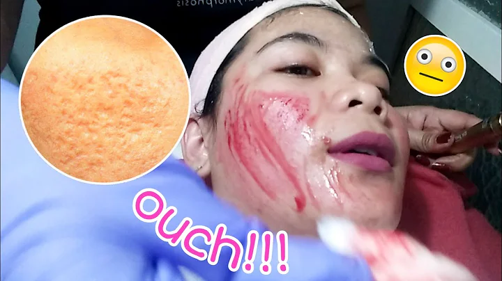 Get rid with those pores!! | April Bautista
