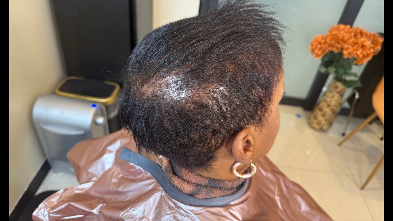 Stress is causing your hair to thin | Hair thinning solutions LIVE