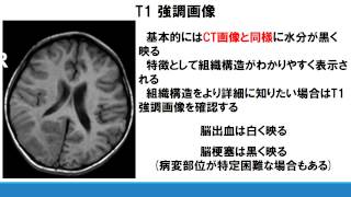 No 11 ＣＴ・ＭＲＩの特徴及び脳血管疾患に対する画像選択
