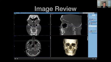 An Hour with the Expert: Understanding Radiology in CBCT with Dr. Peter Green & Brent Garvin