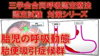 胎児の呼吸動態と胎便吸引症候群　～No 51 三学会合同呼吸療法認定試験対策　シリーズ～