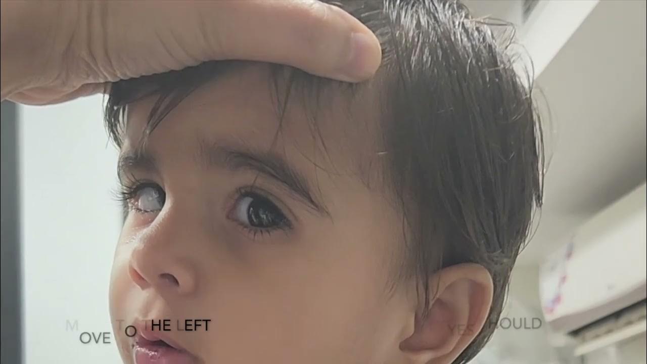 Doll's eye reflex YouTube