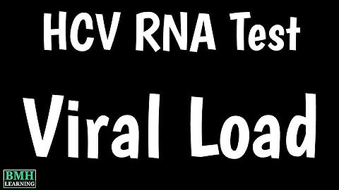 HCV RNA Test | HCV Viral Load | Hepatitis C Viral Load | Quantitative Approach | HCV RNA Testing |