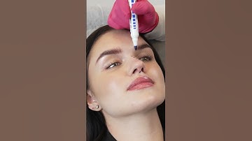 Professional Nose Shaping With Nasal Fillers Cosmedica Aesthetic #shorts #video #medicalaesthetic