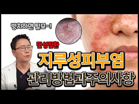 지루성피부염 원인과 치료법, 생활 속 관리법ㅣ방치하면 탈모가 올수 있다?