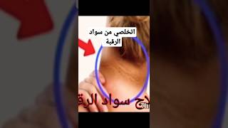 اتخلصي من سواد الرقبة بمكون واحد فقط