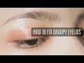 How to Fix Droopy Eyelids