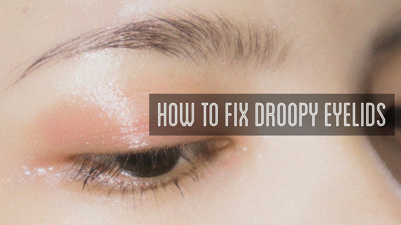 How Can I Fix My Droopy Eyelids Naturally?