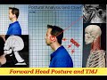 Tmj  forward head posture