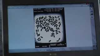 Eyecon:  Accessing pill tray photos over a LAN connection