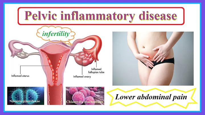 pelvic inflammatory disease - DayDayNews
