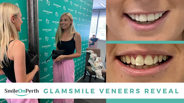 Anna Mills' GlamSmile Reveal