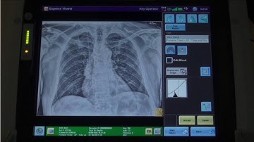 Procedure 2  DirectView Tube and Line