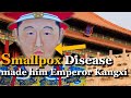 How Emperor Kangxi Controlled Smallpox Disease in China?