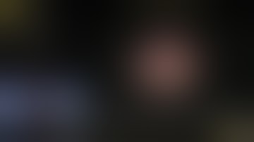 Laparoscopic partial gastrectomy and Roux en Y reconstruction for severe gastroparesis after 10 prev