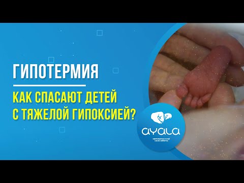 ГИПОТЕРМИЯ. КАК СПАСАЮТ ДЕТЕЙ С ТЯЖЕЛОЙ ГИПОКСИЕЙ? / AYALA