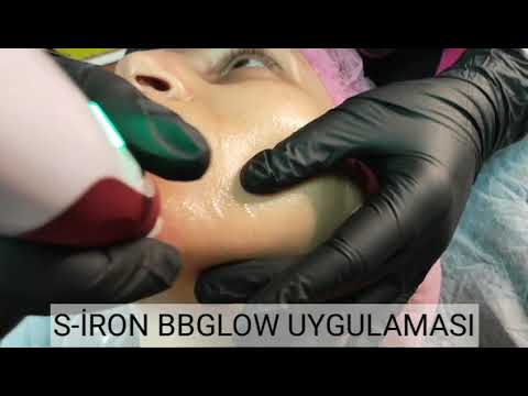 BBGLOW MESO  DİGER ADIYLA (  KALICI FONDOTEN )