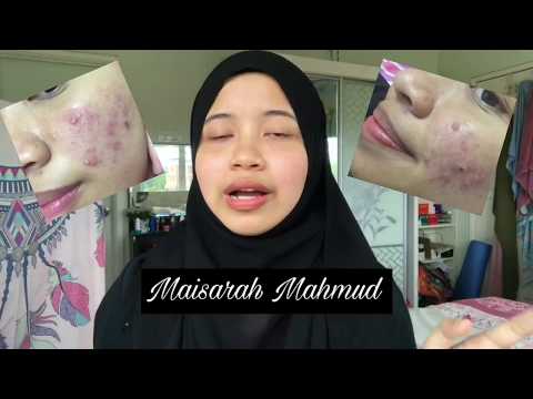 My Acne Story MaisarahMahmud  @maisarahmahmud8639