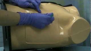 Chest Tube Placement [Tulane Medicine]