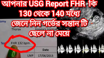 FHR কতো থাকলে ছেলে হয় Original Report|Baby Boy Symptoms During Pregnancy Bengali#baby#FHR#pregnancy