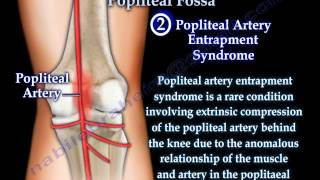 Anatomy Of The Popliteal Fossa - Everything You Need To Know - Dr. Nabil Ebraheim