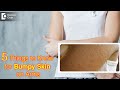 Get rid of Bumpy Skin on Arms | Keratosis Pilaris - Dr. Divya Sharma |Doctors' Circle