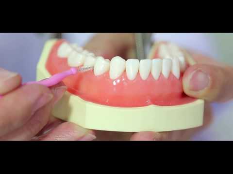 Видео: Мэргэн ухааны шүд яагаад хэрэгтэй вэ, тэдгээрийг доод эрүүнд оруулаад зайлуулах хэрэгтэй